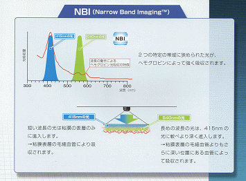 NBI内視鏡の仕組み